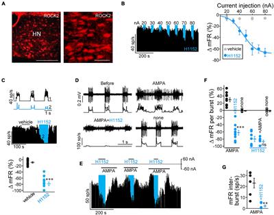 Lysophosphatidic Acid and Several Neurotransmitters Converge on Rho-Kinase 2 Signaling to Manage Motoneuron Excitability